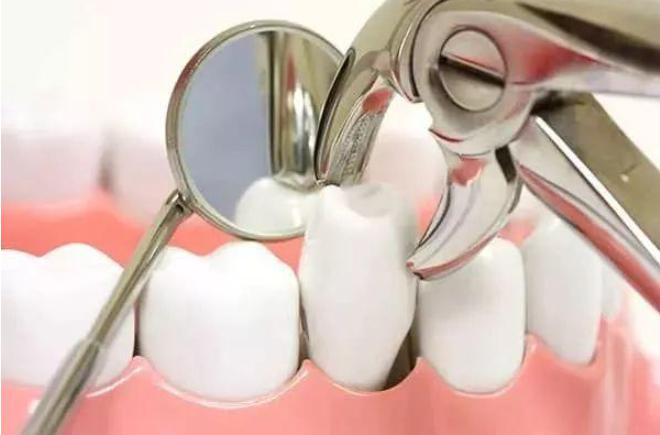 牙又被蛀了？生活中预防龋齿的小妙招