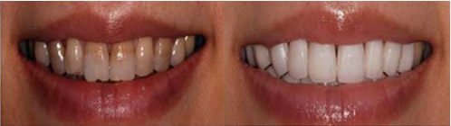 图片13.png 图片13.png