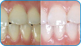 图片9.png 图片9.png