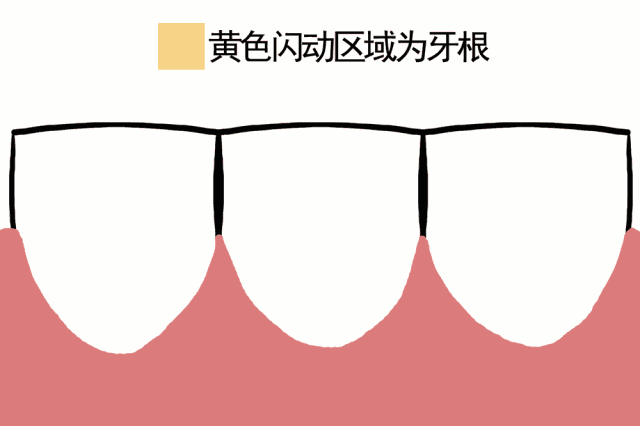 牙齿敏感.gif 牙齿敏感.gif