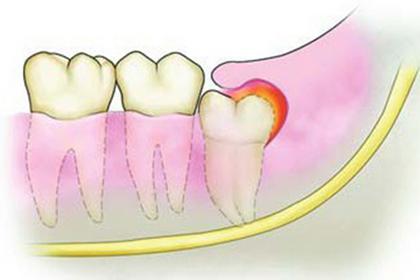 图片3.jpg 图片3.jpg