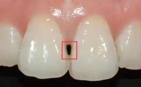 黑三角.jpg 黑三角.jpg