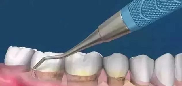 微信图片_20210522171932.jpg 微信图片_20210522171932.jpg