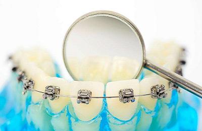 src=http___yh.gzsbyk.com_uploads_image_20190222_1550797902659259.png&refer=http___yh.gzsbyk.jpg src=http___yh.gzsbyk.com_uploads_image_20190222_1550797902659259.png&refer=http___yh.gzsbyk.jpg