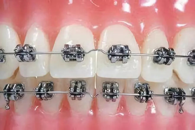 src=http___5b0988e595225.cdn.sohucs.com_images_20180528_4aa3005634d045ceb43448caec6cabab.jpg&refer=http___5b0988e595225.cdn.sohucs.jpg src=http___5b0988e595225.cdn.sohucs.com_images_20180528_4aa3005634d045ceb43448caec6cabab.jpg&refer=http___5b0988e595225.cdn.sohucs.jpg